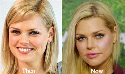 sophie monk bf|sophie monk before and after.